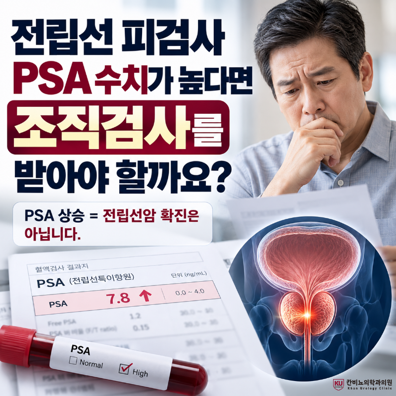 전립선피검사 PSA수치가 높다면 조직검사를 받아야 할까요?