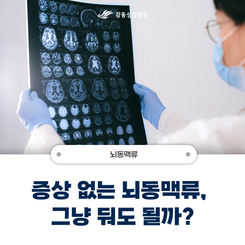 증상 없는 뇌동맥류, 그냥 둬도 될까?