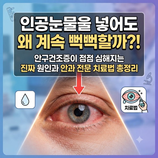 "인공눈물을 넣어도 왜 계속 뻑뻑할까?!"｜안구건조증이 점점 심해지는 진짜 원인과 안과 전....