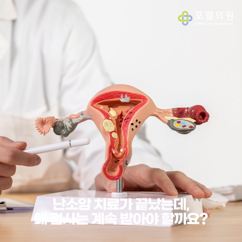 난소암 치료가 끝났는데, 왜 검사는 계속 받아야 할까요?