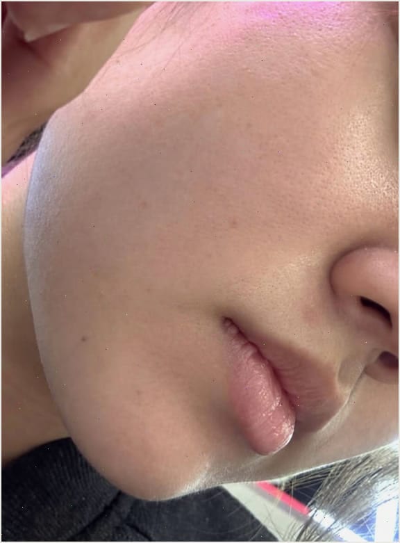 스트라이덱스센시티브패드 민감성 관리 방법