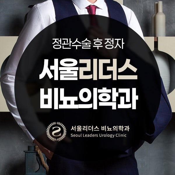 정관수술 후 정자 생존기간과 정액검사 시기 기준