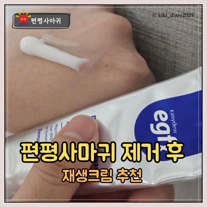 편평사마귀 제거 후, 재생크림 추천