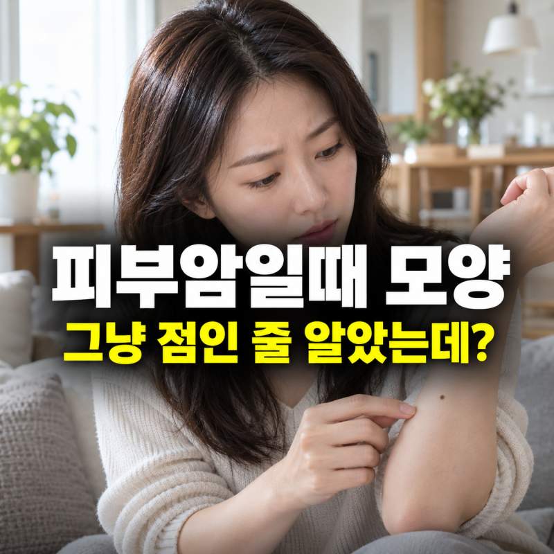 피부암일때 모양, 점과 다르게 보이는 변화는 무엇일까요?