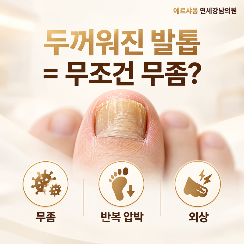 당진 무좀, 발톱이 두꺼워지고 변색됐다면 확인해보세요