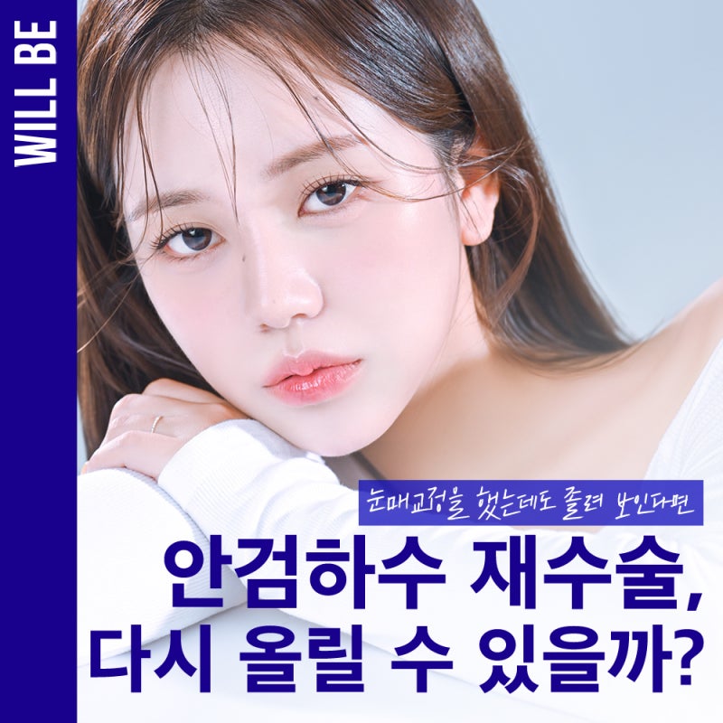 안검하수 재수술, 다시 올릴 수 있는 눈일까