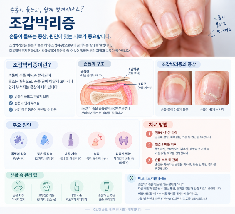 조갑 박리증 이란?