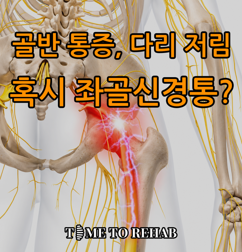 도수치료를 받을 땐 편했던 수원 좌골신경통, 왜 며칠 못 가고 되돌아올까