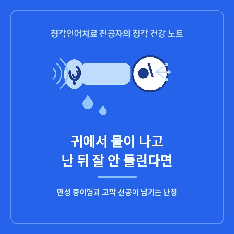 귀에서 물이 나고 난 뒤부터 잘 안 들린다면: 만성 중이염과 고막 천공이 남기는 난청