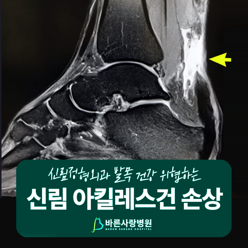 신림 바른사랑병원｜아킬레스건염·아킬레스건 파열 증상과 치료✨