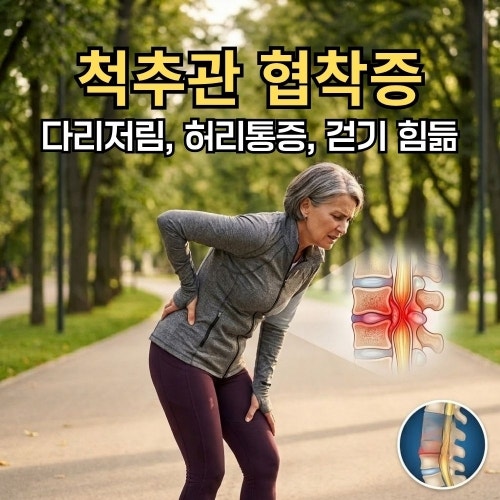 척추협착증증상과 척추관 협착증 치료방법, 허리디스크 차이와 운동법까지