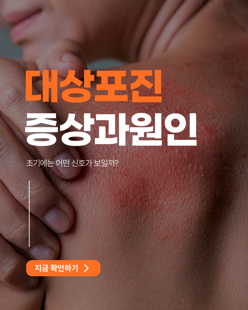 대상포진 증상 원인 정리 초기에는 어떤 신호가 보일까?