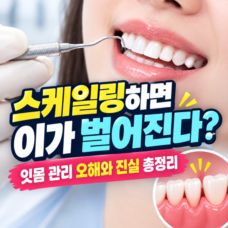 스케일링하면 이가 벌어진다? 잇몸 관리 오해와 진실 총정리