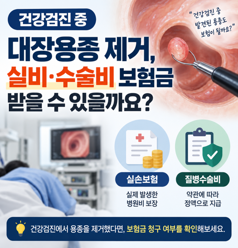 건강검진 중 발견된 용종, 제거하면 보험금은 어떻게 될까?