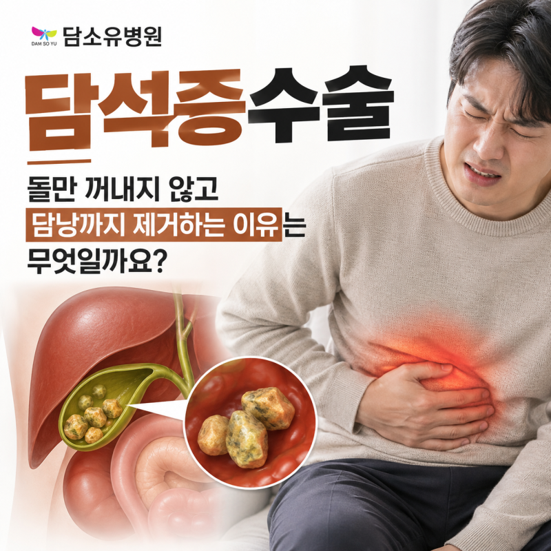 담석증수술 담낭까지 제거하는 이유는 무엇일까요?