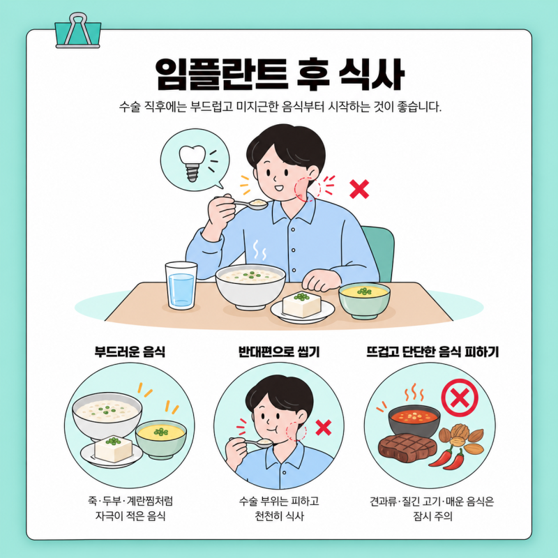 임플란트 후 식사와 운동 등 생활 전반에 주의사항 총정리