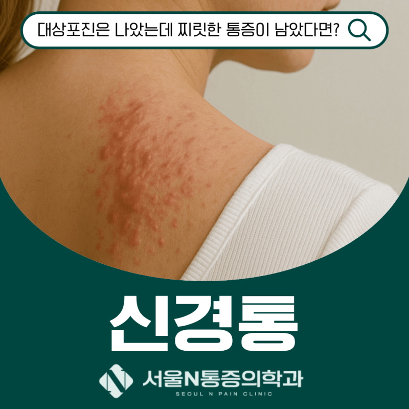 [여의도 정형외과] 대상포진은 나았는데 찌릿한 통증이 남았다면? 대상포진 후 신경통 치료 ....