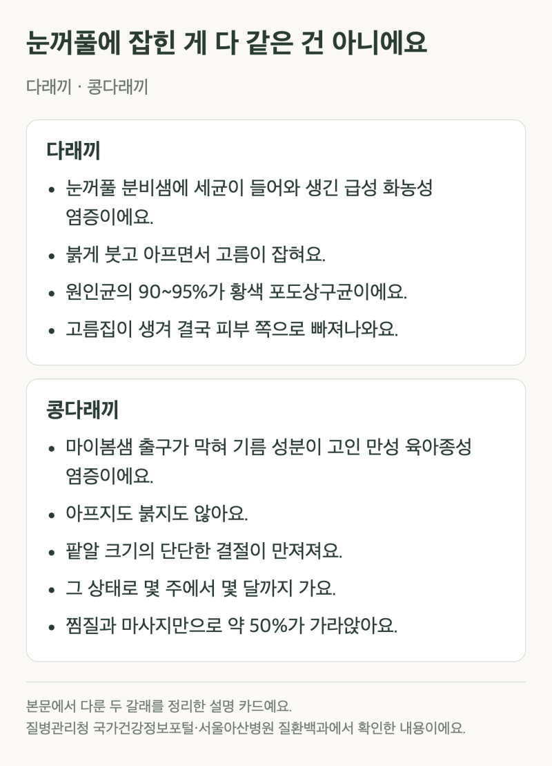 다래끼 콩다래끼 차이, 눈꺼풀 몽우리가 안 아프면 어느 쪽일까?