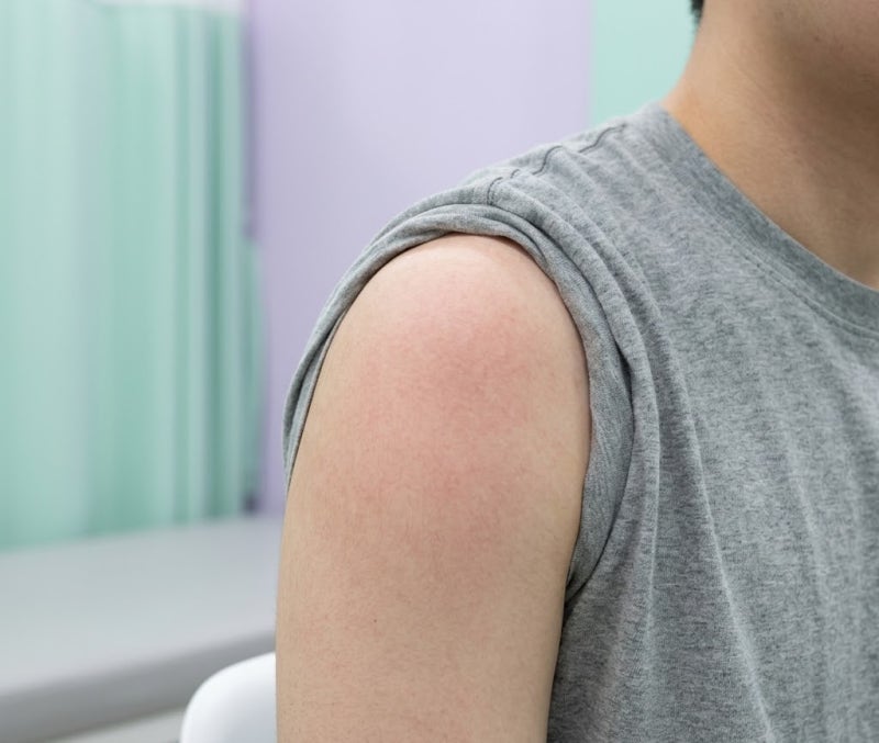 콜린성 두드러기 원인과 증상, 땀띠 차이부터 관리법 총정리