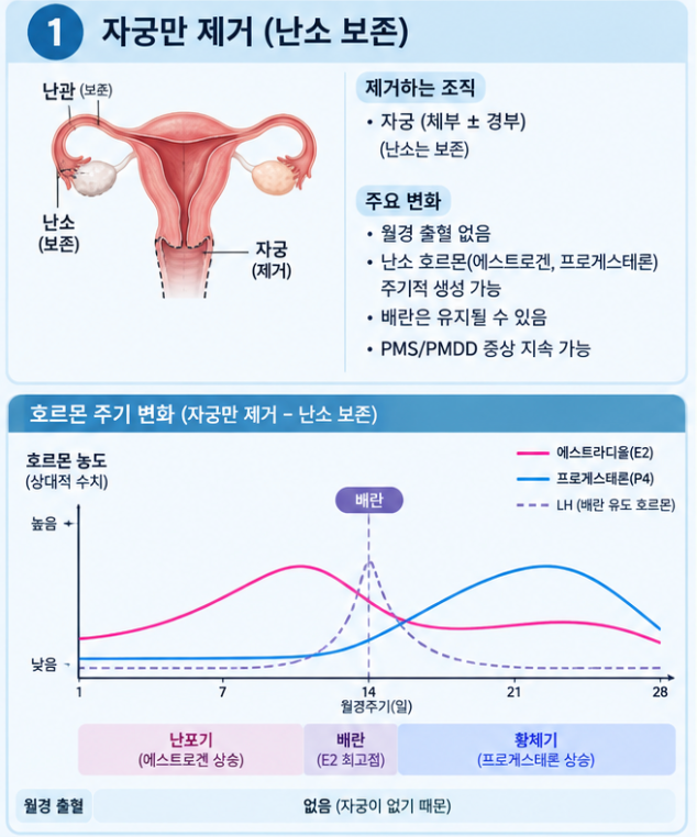 [인천PT] 청라,가정동PT 여성운동전문가 진쌤: 자궁적출수술 후 운동, 어떻게 해야할까??