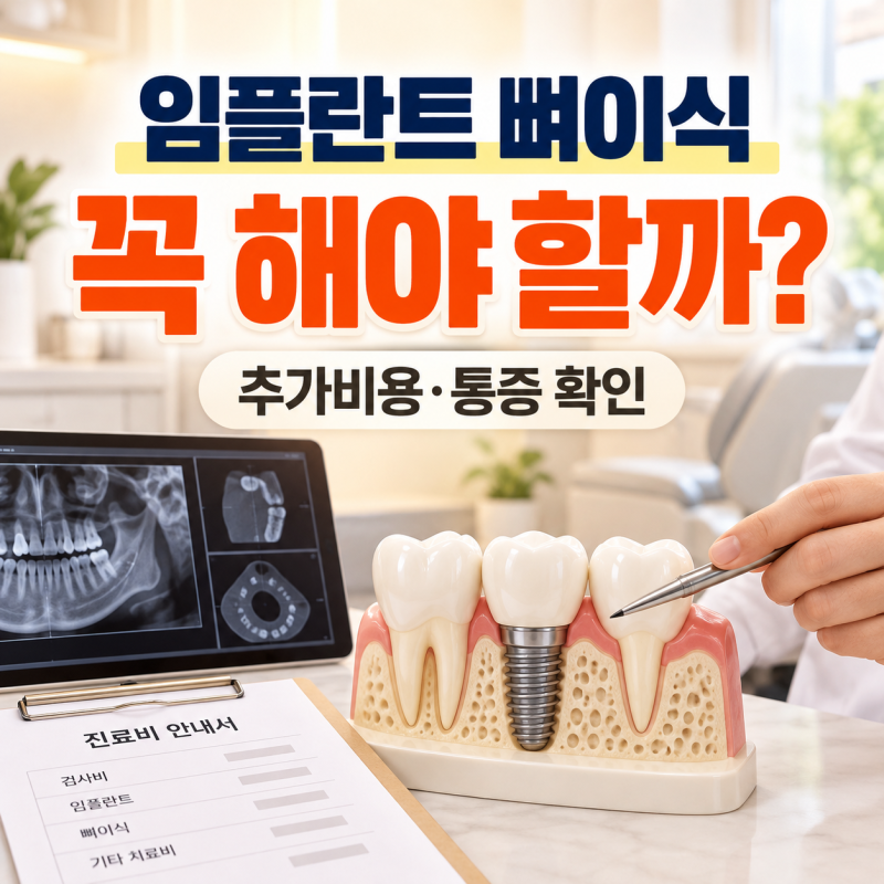 임플란트 뼈이식 하자는데 꼭 해야 할까? 추가비용·통증까지 확인