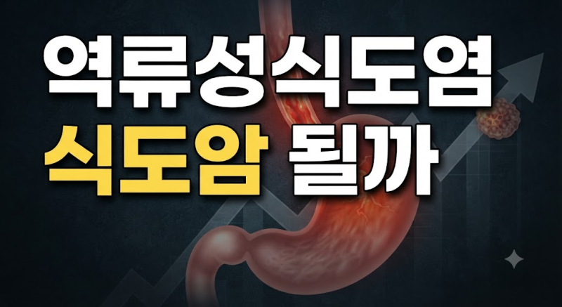 역류성식도염이 오래되면 정말 식도암이 될까? 두 질환의 명확한 차이와 연관성
