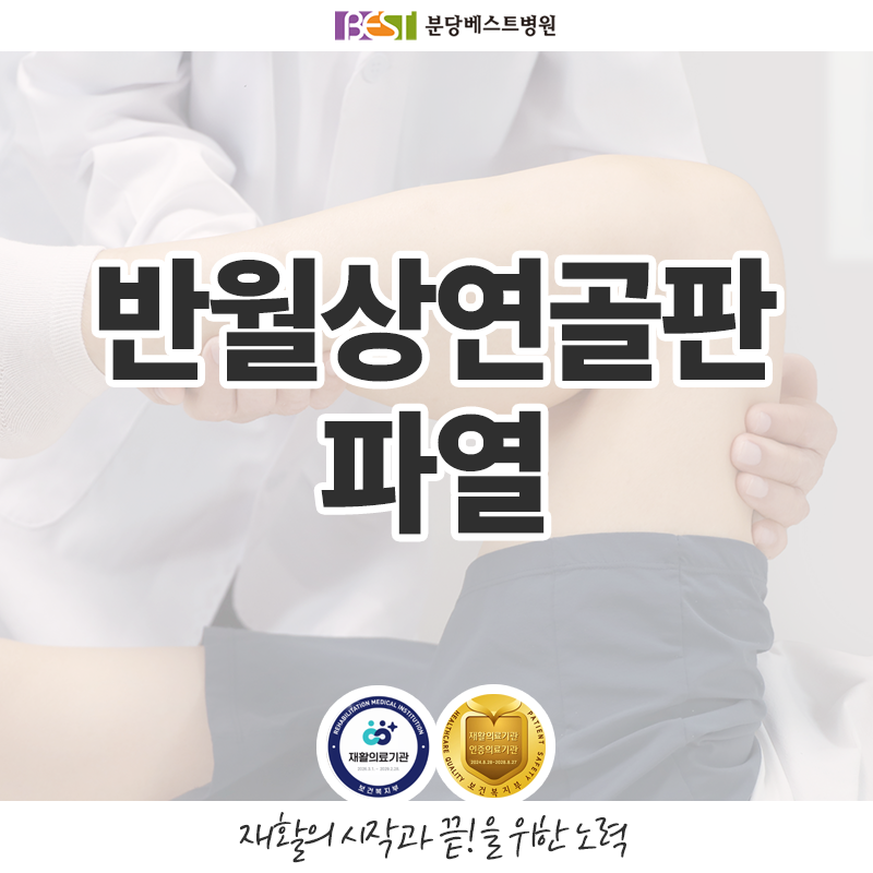 반월상연골판 파열, 무릎이 잠기거나 돌릴 때 아프다면 확인할 점