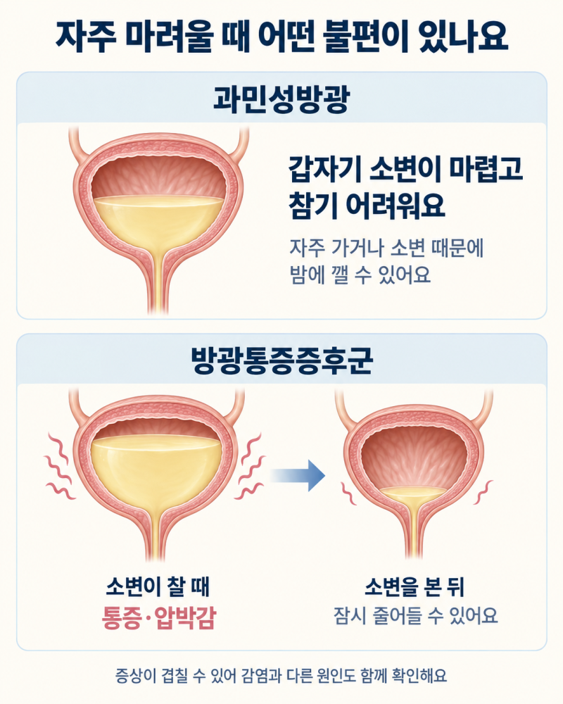 [방광염이 자꾸 재발합니다 ④] 소변검사는 정상인데 계속 마렵고 불편합니다