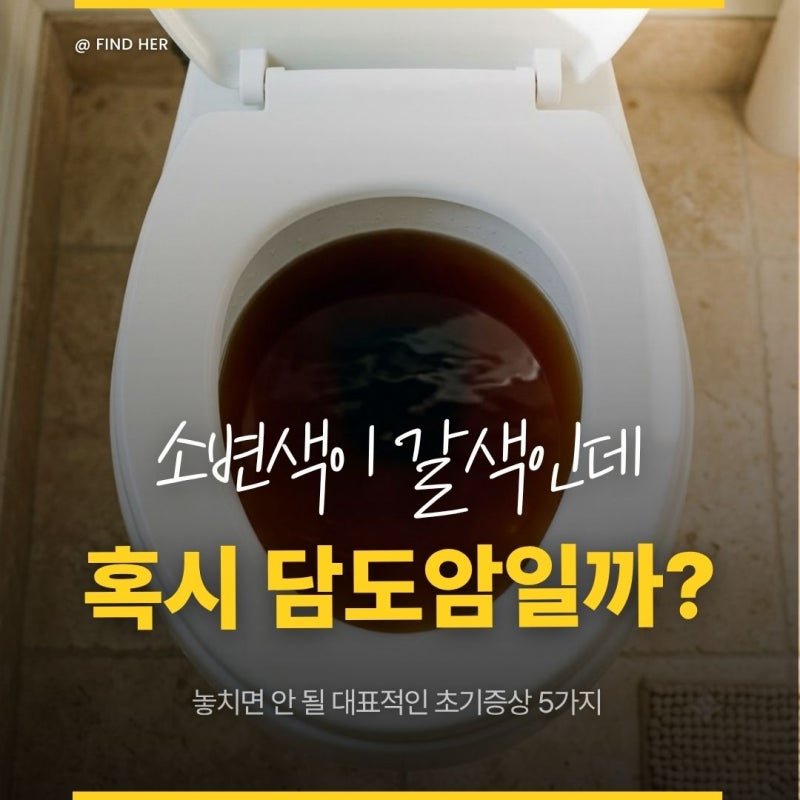 "소변 색이 짙어졌다면" 놓치면 안 될 담도암 초기증상 5가지