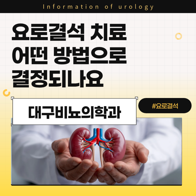 대구비뇨의학과 요로결석 치료 어떤 방법으로 결정되나요