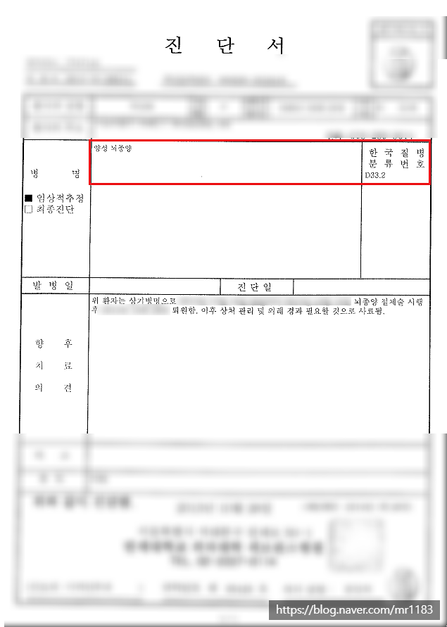 양성뇌종양(D33) 일반암 진단비 지급 가능성