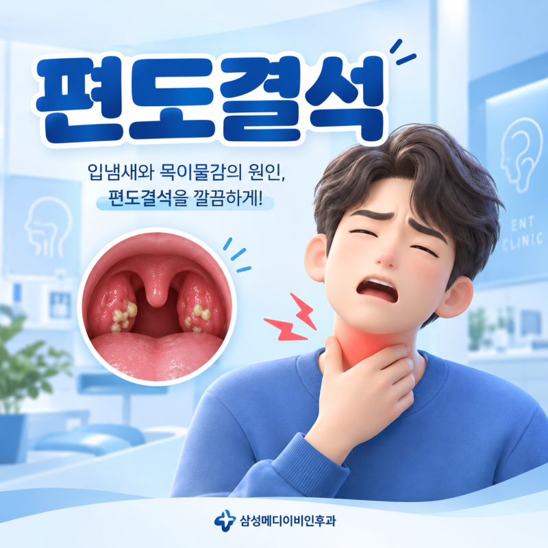 부산 편도결석, 목에 낀 하얀 알갱이 원인부터 치료 방법까지