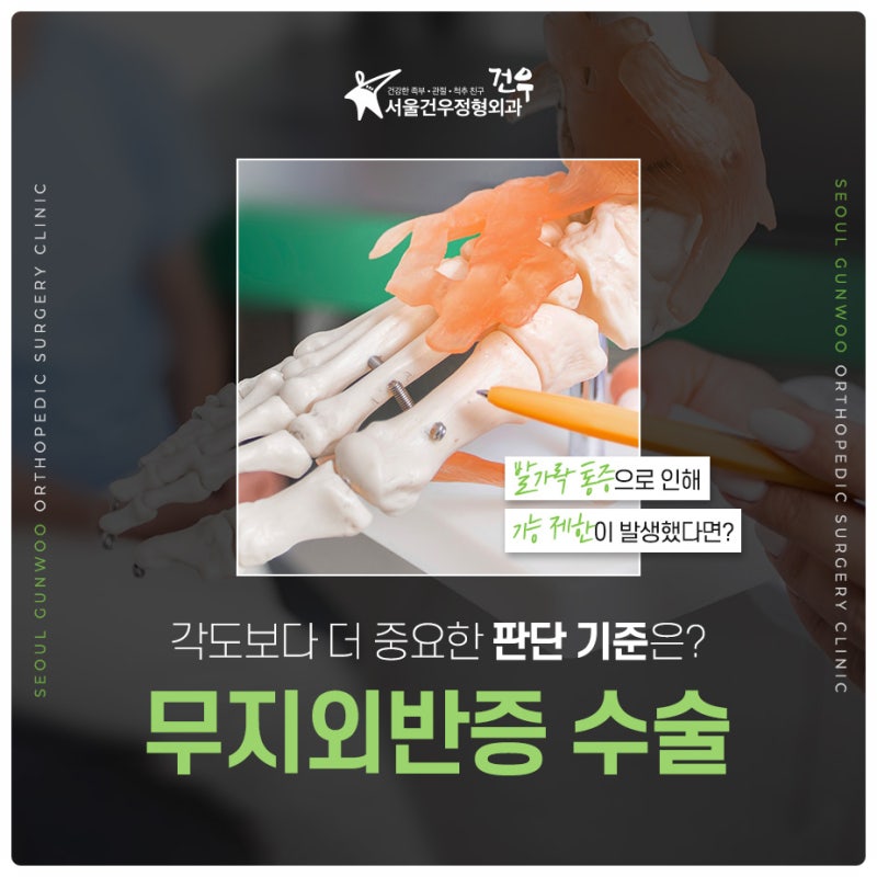 편한 운동화를 신어도 발이 아프다면? 무지외반증 단계별 치료와 관리법
