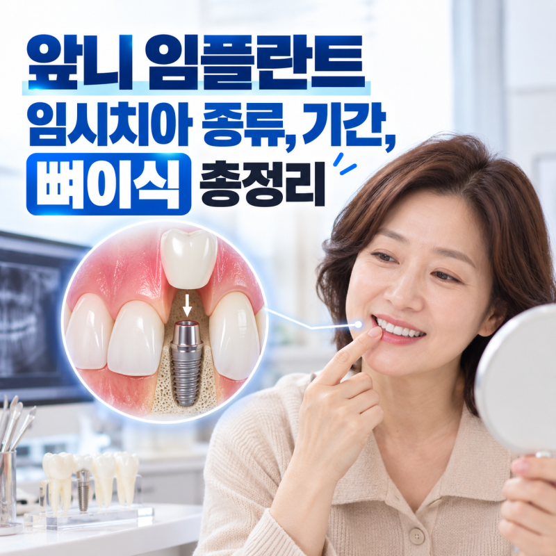 압구정로데오치과 앞니 임플란트 임시치아 종류, 기간, 뼈이식 총정리