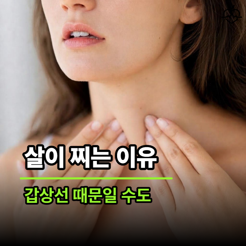 "살이 찌는 이유가 따로 있었습니다.." 의사들이 말하는 갑상선기능저하증 초기증상 7가지