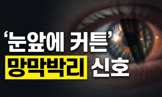 망막박리 증상 원인 치료 수술비 총정리(+후기)