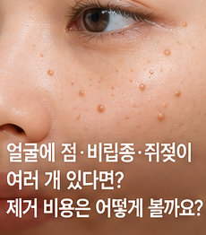 얼굴 점·비립종·쥐젖이 여러 개 함께 있다면? 수십 개 제거 비용과 무제한 기준