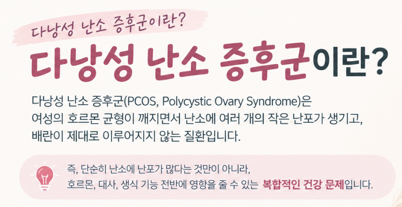 다낭성 난소 증후군 증상, 도움되는 영양제 이노시톨!