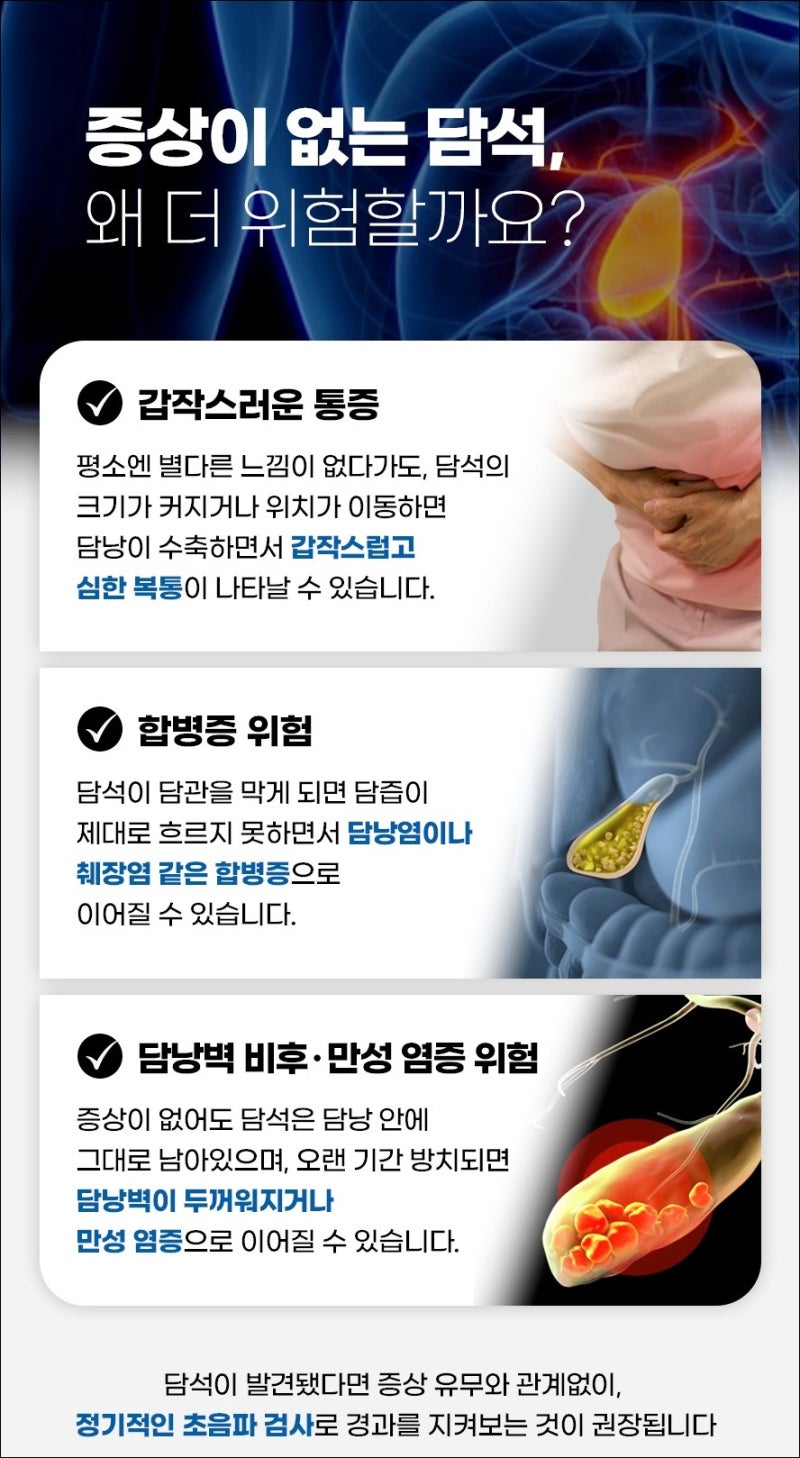 "명절 음식 먹고 체한 줄 알았는데.." 반복되는 오른쪽 윗배 통증, 담석증일 수 있다는데