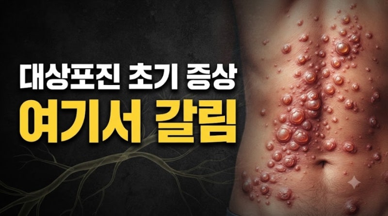 대상포진 초기 증상 부위별 특징 (얼굴, 팔, 다리, 허벅지, 귀, 두피)과 대처법, 병원 치료 방....