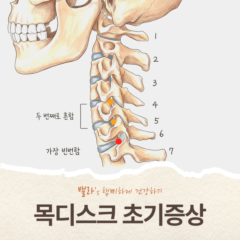목디스크 증상 3가지와 치료법, 어깨 통증인 줄 알았던 저림 구분법