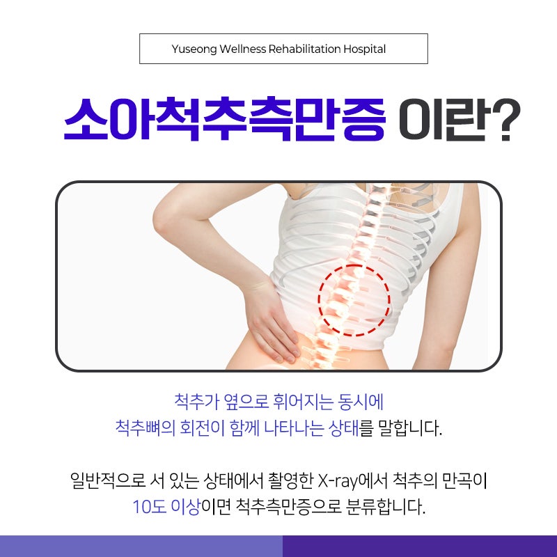 유성 척추병원, 소아에게도 척추측만증이?!