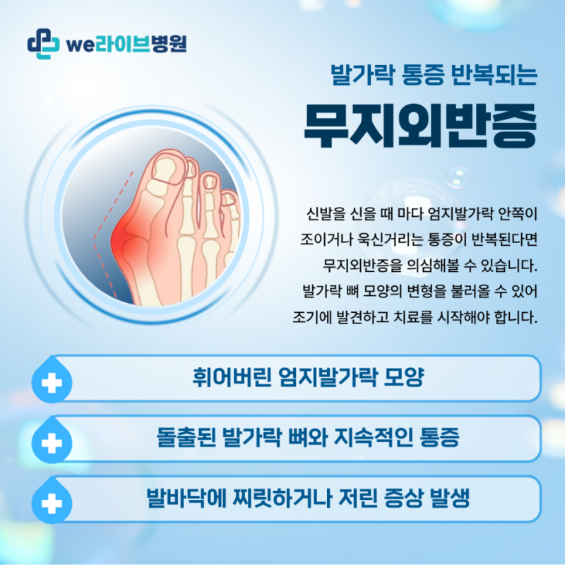 휘어진 엄지발가락을 방치하면 안되는 이유는? 무지 외반증 초기 관리 중요한 이유