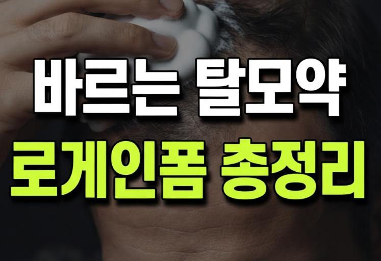 로게인폼 성분 바르는법 여성 효과 후기 총정리