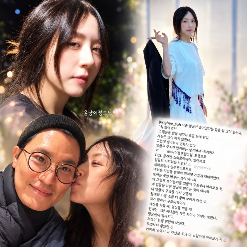 65세 서정희 얼굴 변화 이유 직접 밝혔다…“많이 안 했는데 변화 컸다” 시술 고백