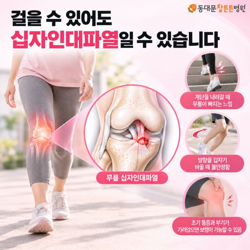 무릎 십자인대 파열 걷기는 괜찮은데 무릎이 자꾸 휘청거린다면?