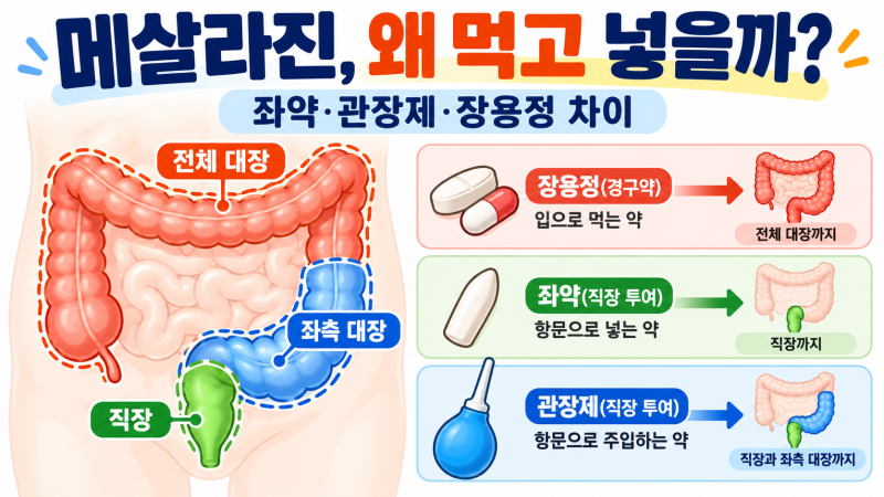 메살라진 효과·부작용｜궤양성 대장염에 왜 쓸까? 좌약·관장제·장용정 차이까지