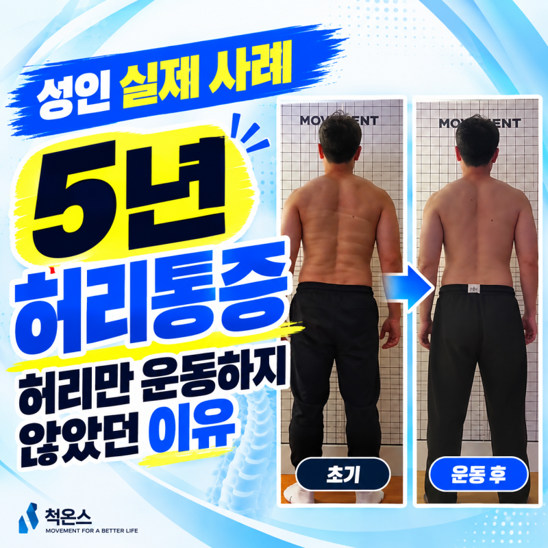 허리통증 운동, 5년간 반복된 통증에 허리만 운동하지 않은 이유