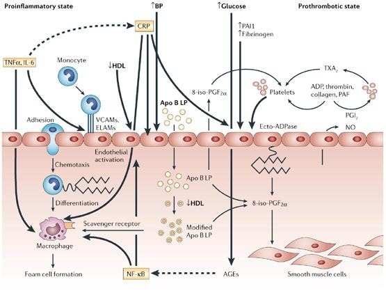 대사증후군 Metabolic syndrome: 배가 조금 나왔을 뿐인데, 몸속 다섯 개의 경고등이 함께 켜졌습....