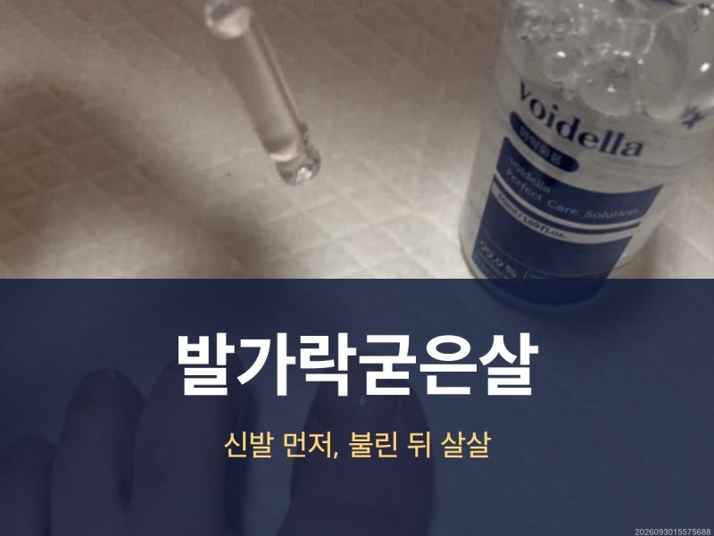 발가락굳은살 다시 생기는 이유, 신발부터 다듬기까지 정리